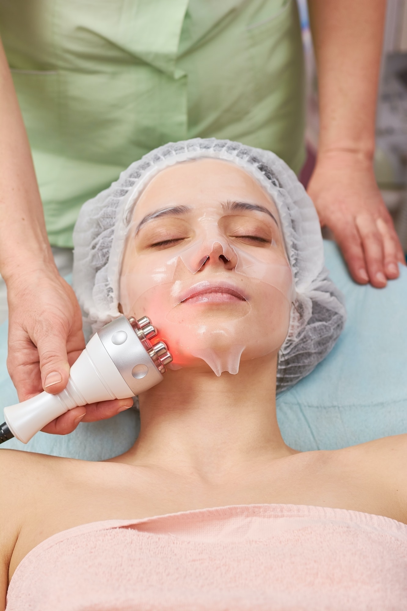 Rf face lift, young woman